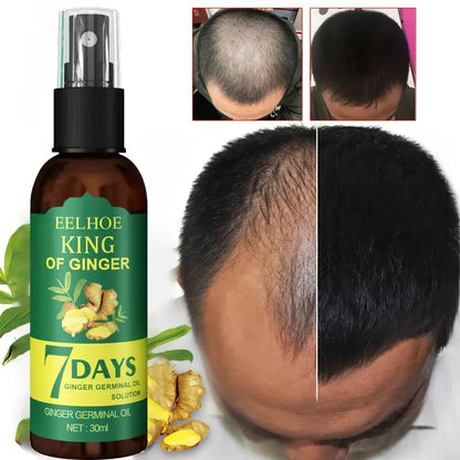 3 Bottle EELHOE King of Ginger Hair Growth Spray